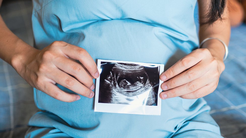 Беременная женщина, держащая снимок будущего ребенка